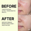 Celimax Vita-A Retinal Shot Tightening Booster with 0.1% Retinal, Matrixyl & Niacinamide | Pore Minimizer, Wrinkles & Fine Lines, Firmer Skin, Korean Face Serum (15ml)