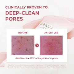 SKIN1004 Poremizing Deep Cleansing Foam 125ml, Makeup Remover, Korean Face Cleanser with Himalayan Pink Salt & Madagascar Centella Asiatica for Facial Pore Cleansing, Korean Skin Care