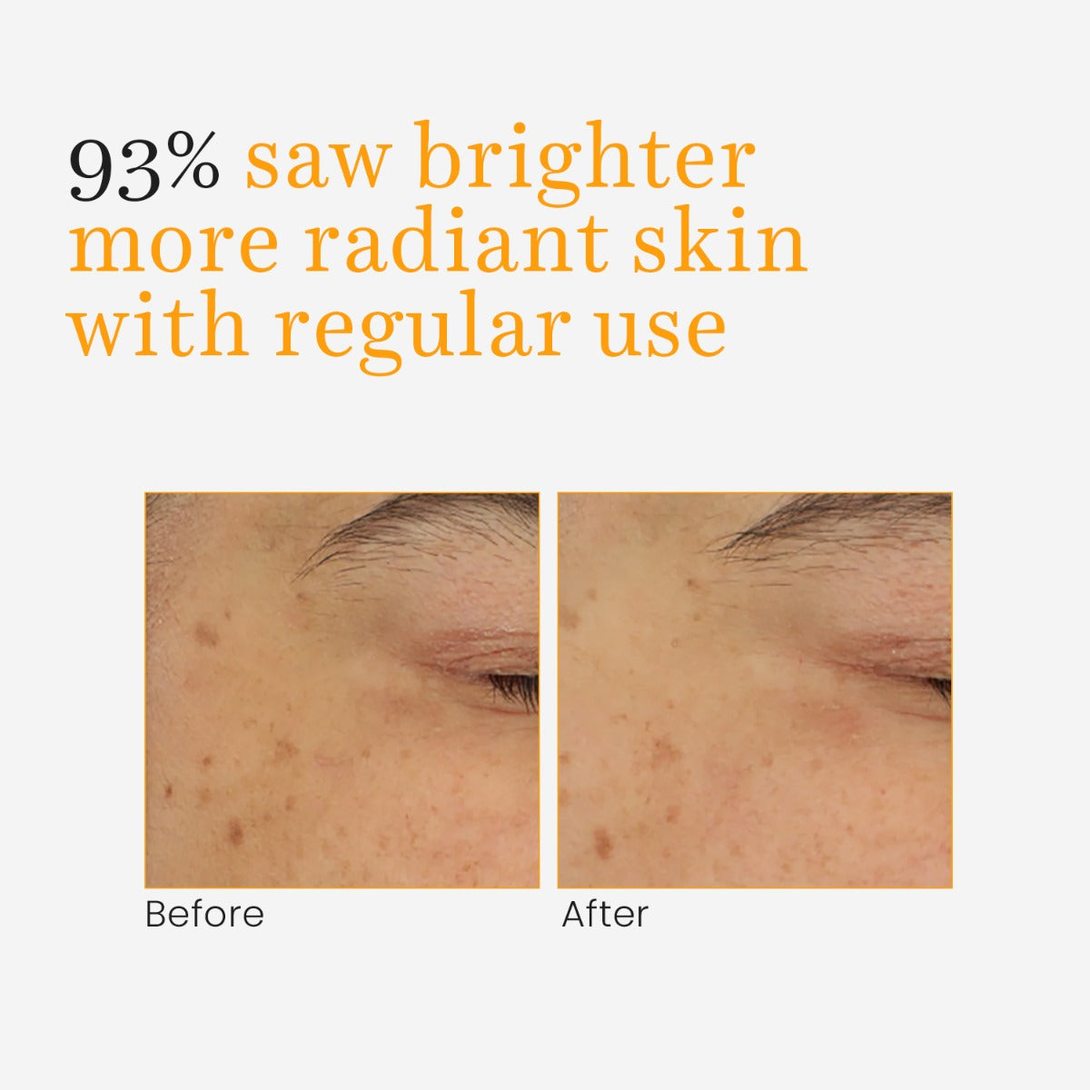 O3+ Skins Lutions Vitamin- C & Turmeric Glow Gel Cream 50g - Pinkbliss