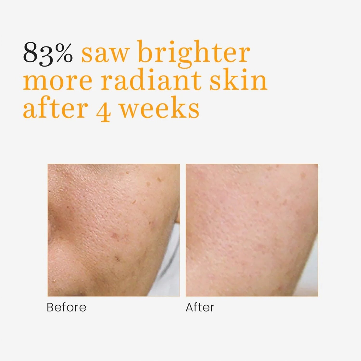 O3+ Skins Lutions Vitamin C Serum Glow- Face and Neck Serum 30ml - Pinkbliss