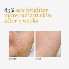 O3+ Skins Lutions Vitamin C Serum Glow- Face and Neck Serum 30ml - Pinkbliss