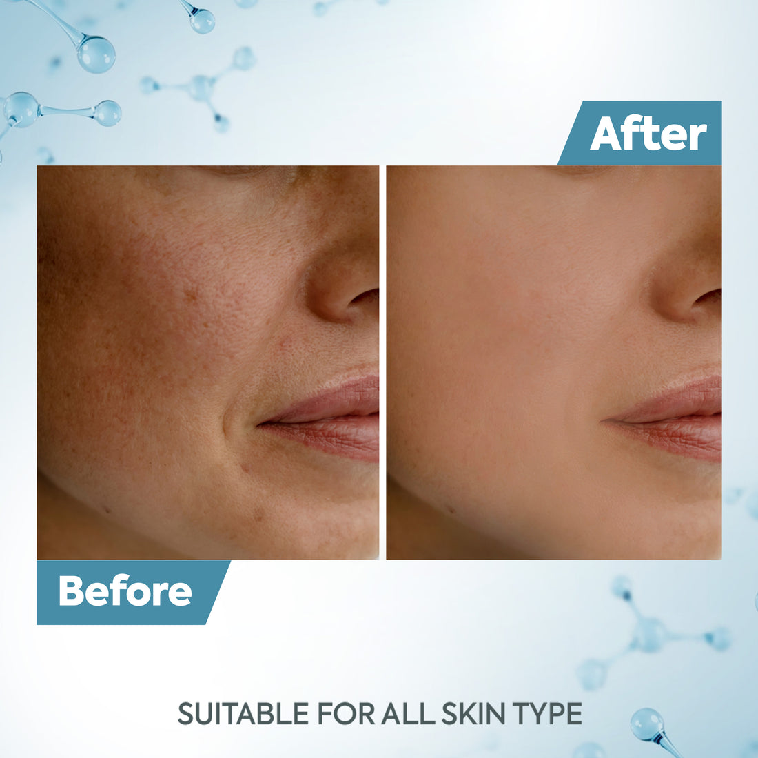 Raaga Professional De-Tan Cream 72GM (12g*6) - Pinkbliss