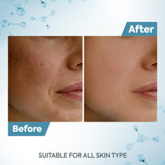 Raaga Professional De-Tan Cream 72GM (12g*6) - Pinkbliss